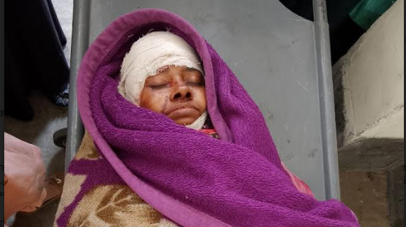 ভাসুরের ছেলের হাসুয়ার আঘাতে চাচি গুরুত্বর জখম